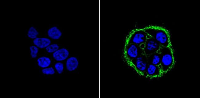 EpCAM Antibody (MA5-13917)