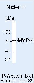 MMP2 Antibody in Immunoprecipitation (IP)