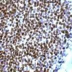 Cyclin D1 Antibody in Immunohistochemistry (Paraffin) (IHC (P))