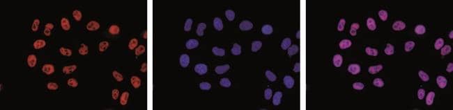 Phospho-RNA pol II CTD (Ser2) Antibody in Immunocytochemistry (ICC/IF)