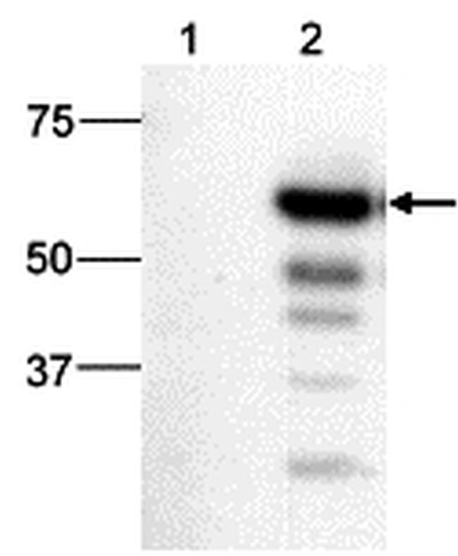 ty1 tag antibody ma5 23513 ty1 tag antibody ma5 23513