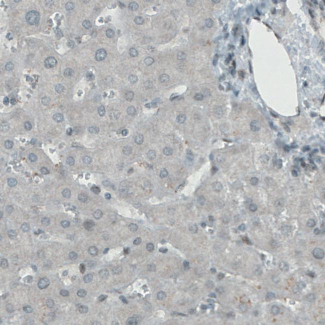 KDM5B Antibody (MA5-24626)