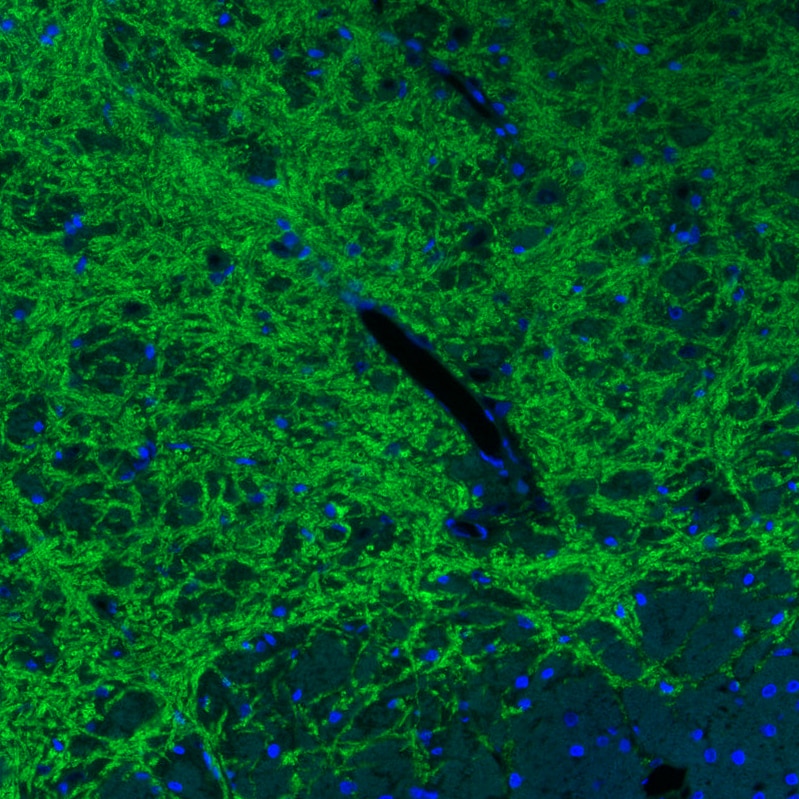 VGAT Antibody (MA5-24643)