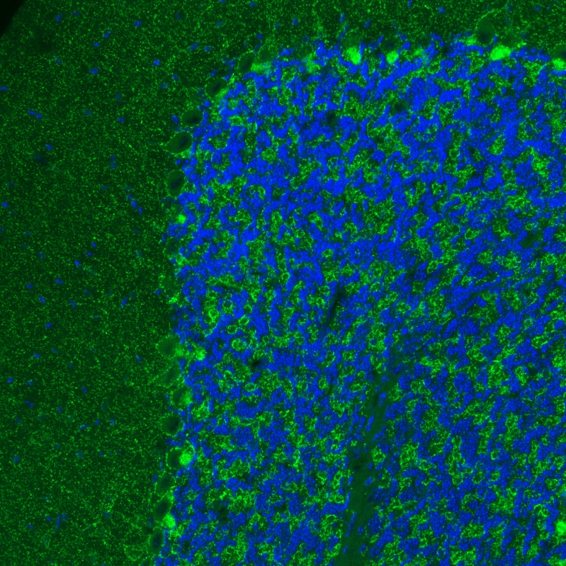 VGAT Antibody (MA5-24643)