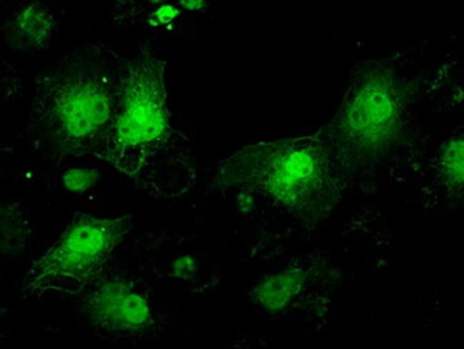 ILF2 Antibody (MA5-24988)