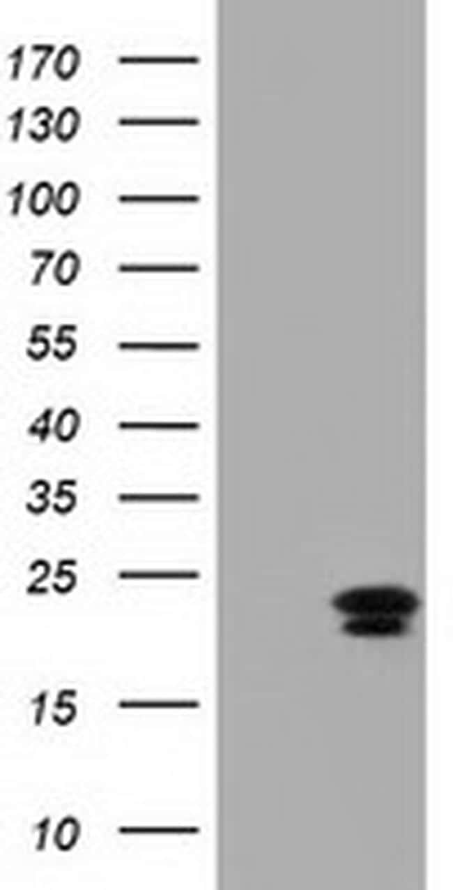 Ephrin A2 Antibody in Western Blot (WB)