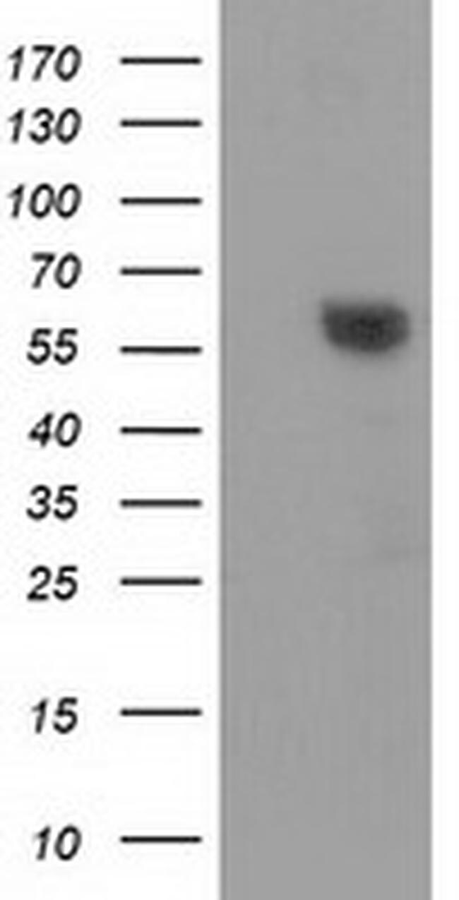 DTNA Antibody (MA5-25361)