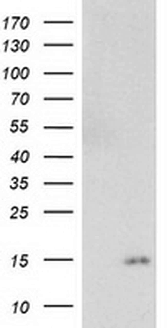 NDUFA7 Antibody in Western Blot (WB)