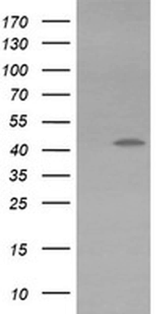 KVbeta1 (KCNAB1) Antibody in Western Blot (WB)