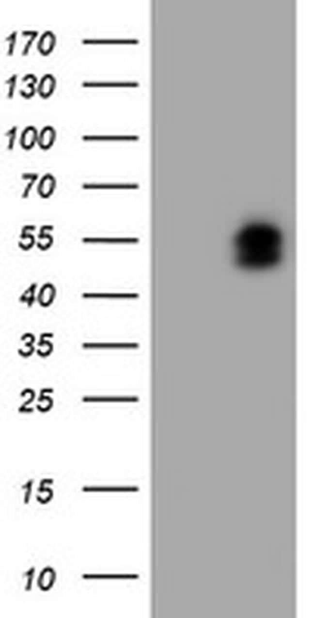 LIM1 Antibody in Western Blot (WB)