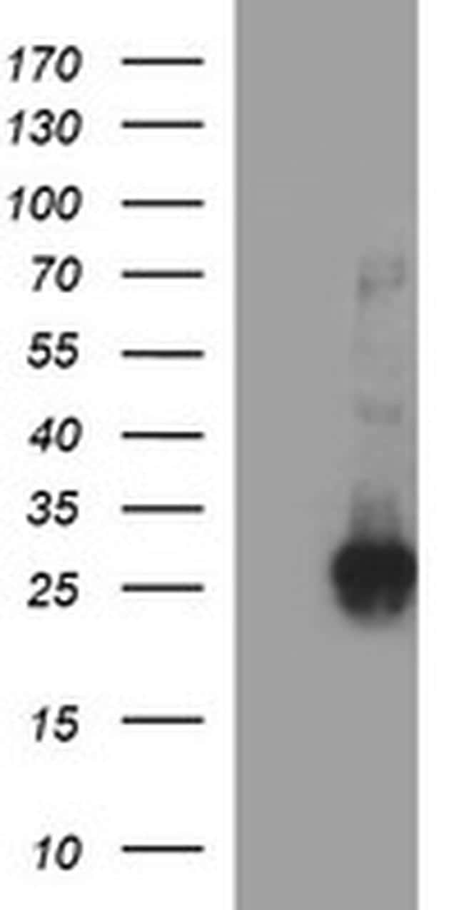 CHAC1 Antibody (MA5-26311)