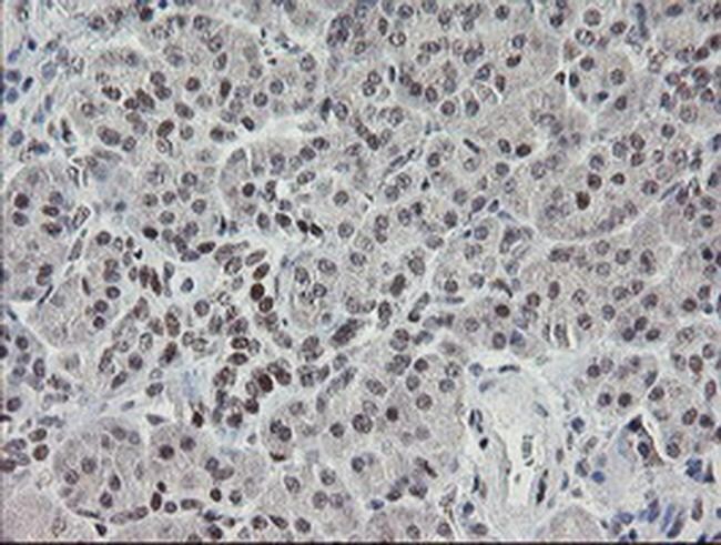 TLE1 Antibody in Immunohistochemistry (Paraffin) (IHC (P))