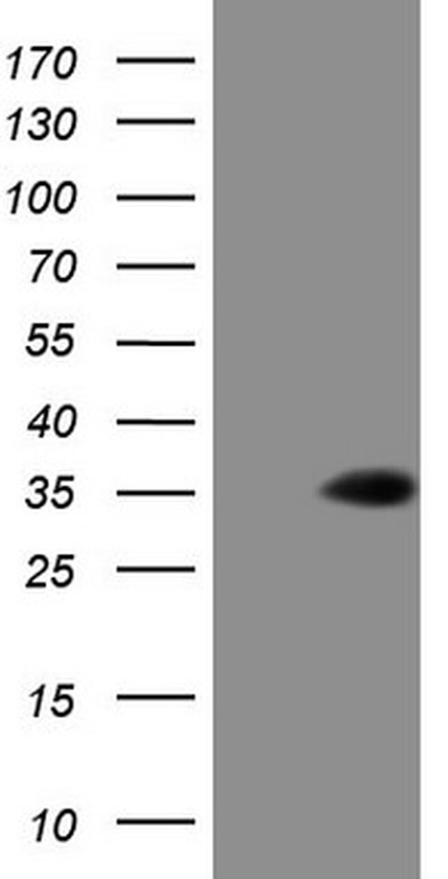 TCEAL1 Antibody in Western Blot (WB)
