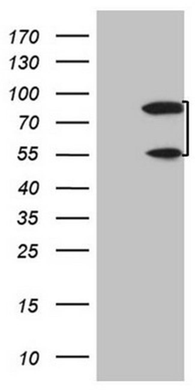 SP110 Antibody in Western Blot (WB)