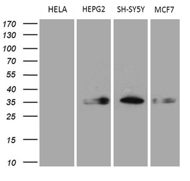 CBR1 Antibody (MA5-27219)