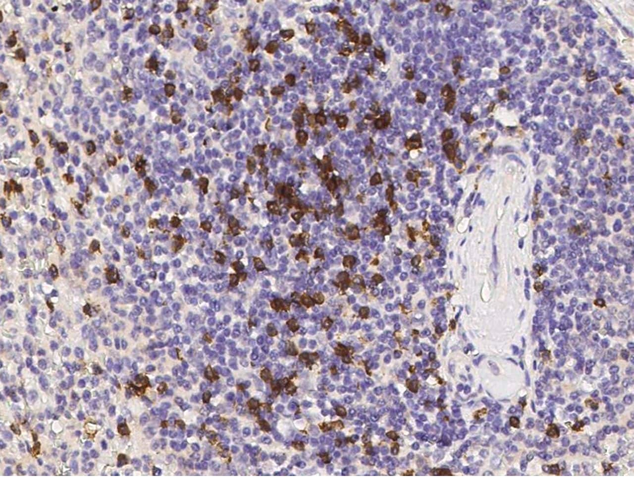 CD8 beta Antibody (MA5-29134)