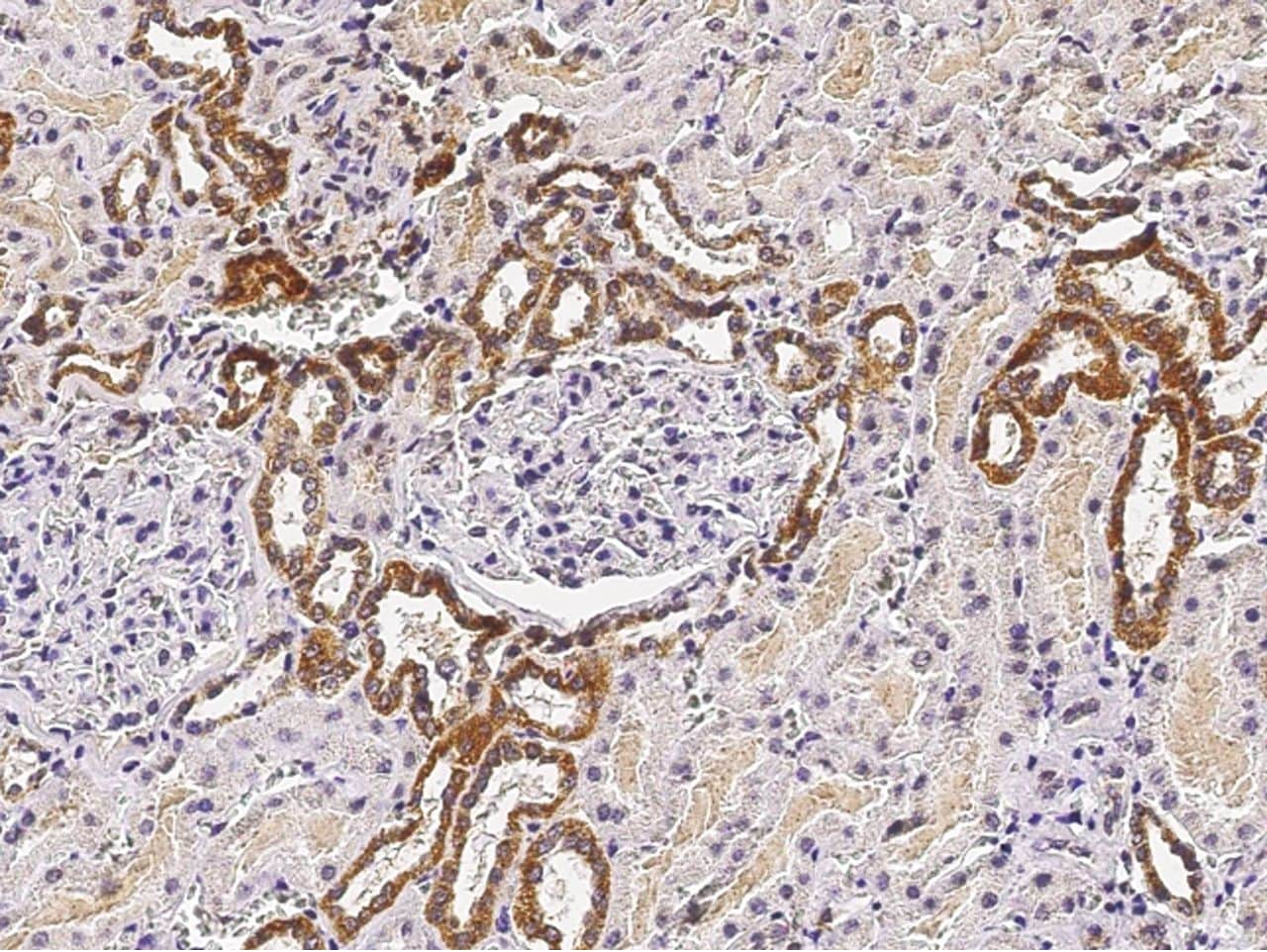 ST6GAL1 Antibody (MA5-29582)