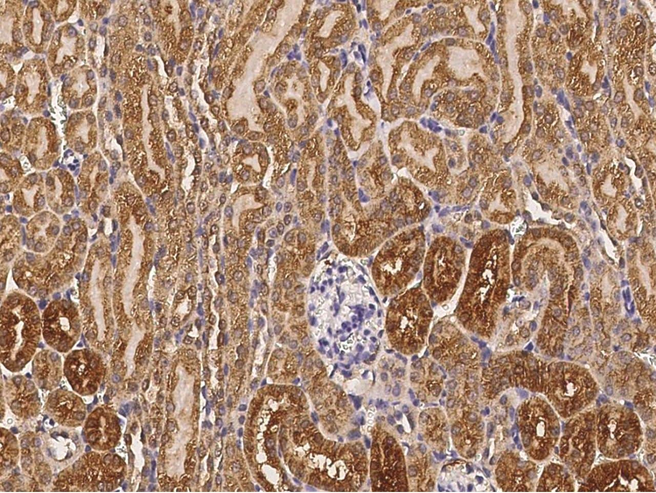 Cathepsin B Antibody (MA5-29693)