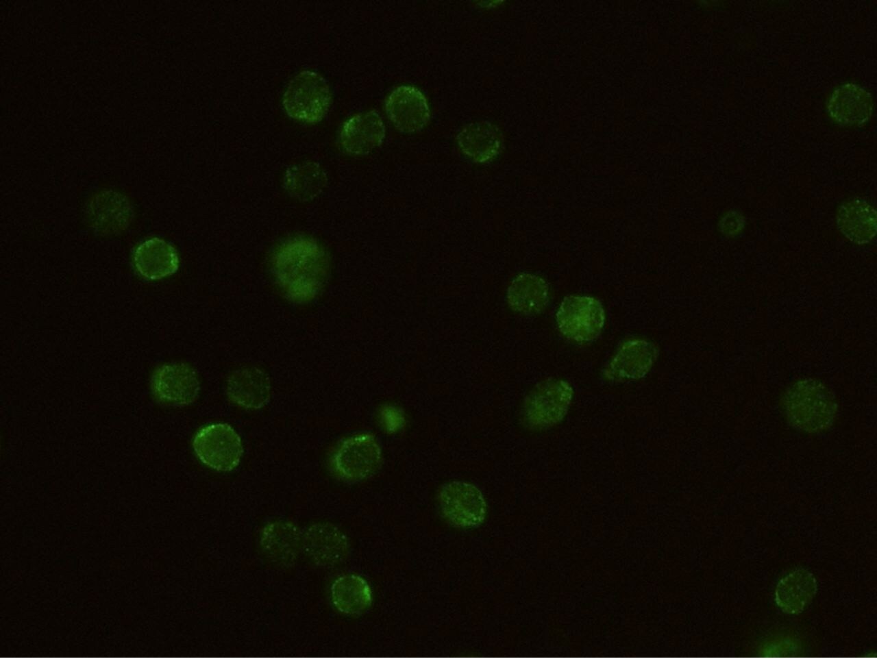 IL2RG Antibody (MA5-29720)