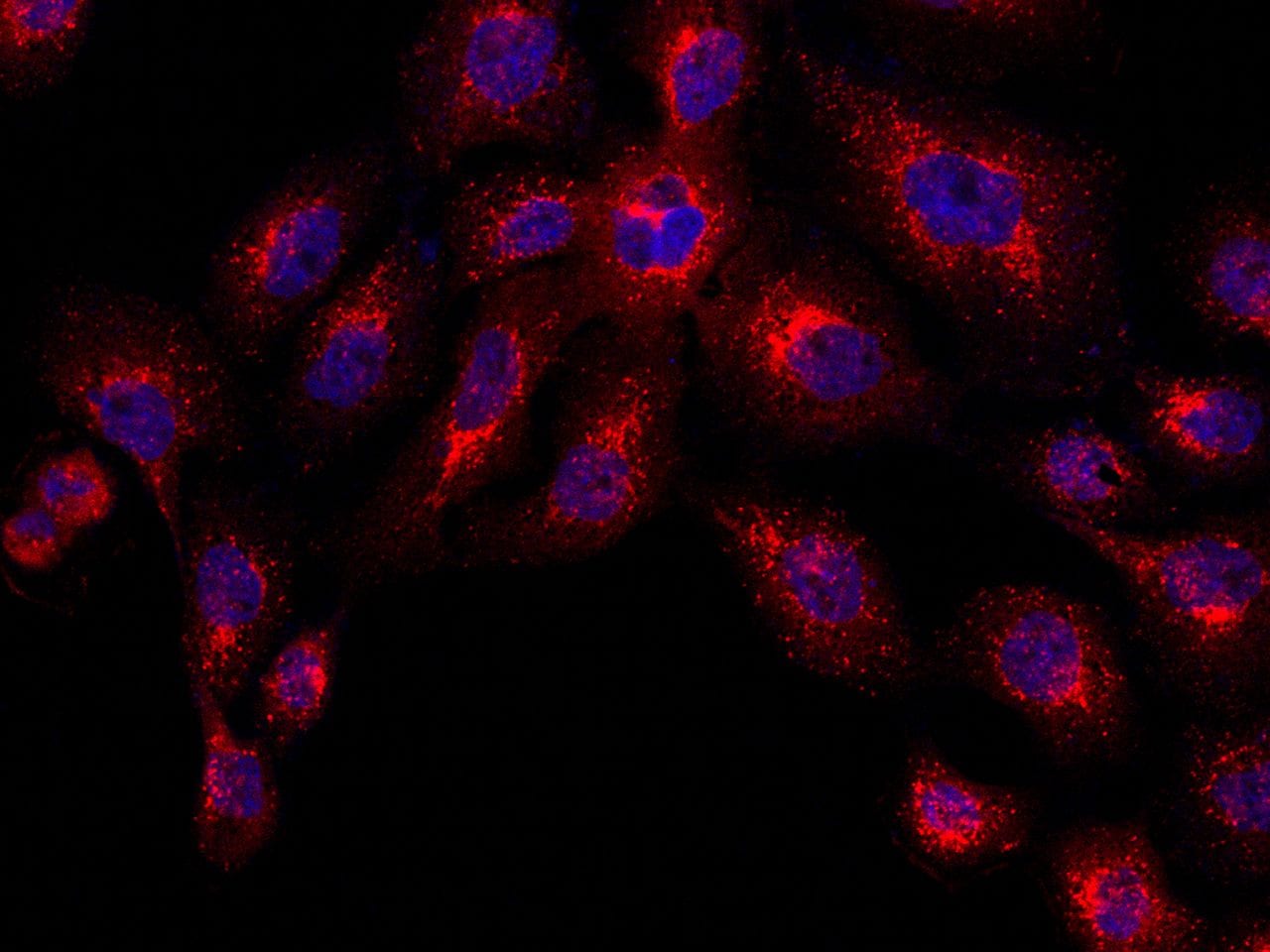 Cathepsin D Antibody (MA5-30459)