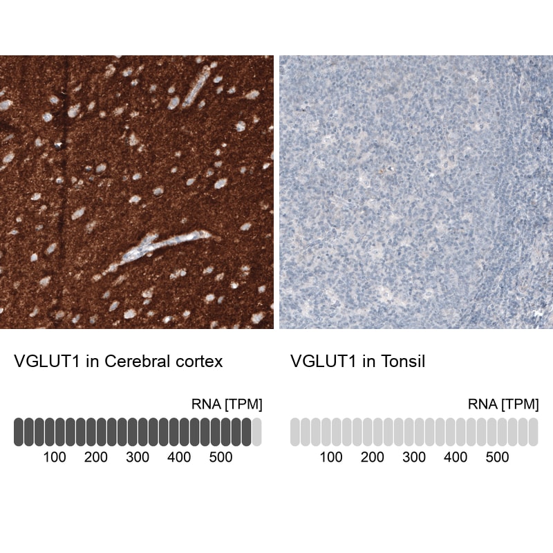 VGLUT1 Antibody in Immunohistochemistry (IHC)