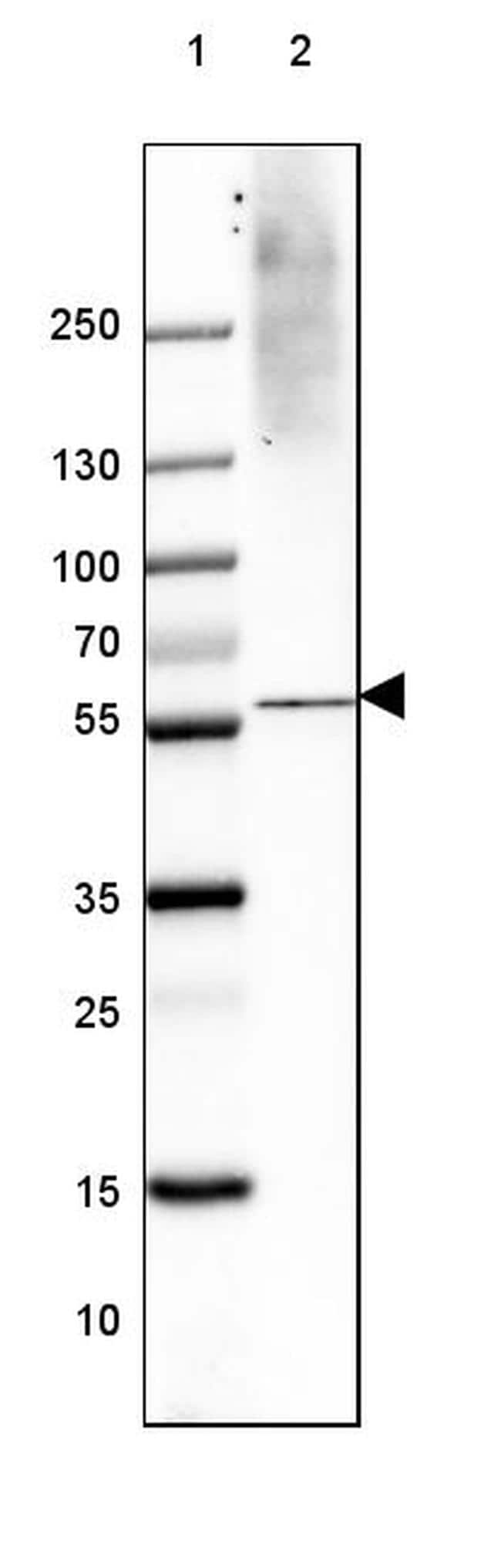 VGLUT1 Antibody in Western Blot (WB)