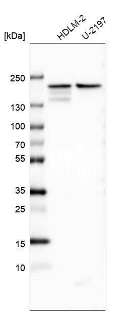 CLIP1 Antibody in Western Blot (WB)