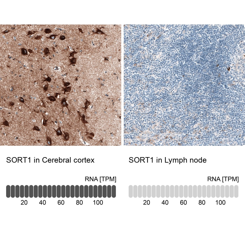 Sortilin Antibody in Immunohistochemistry (IHC)