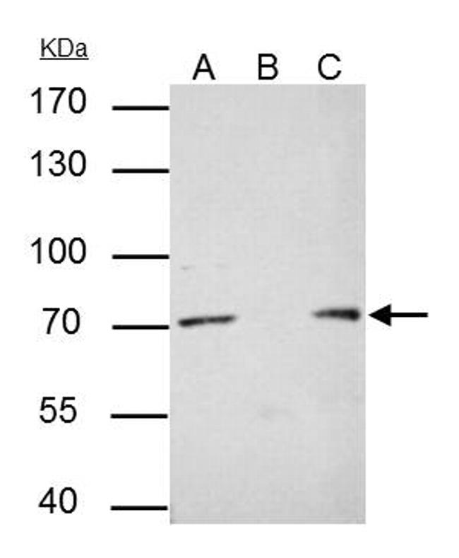 PRMT5 Antibody in Immunoprecipitation (IP)