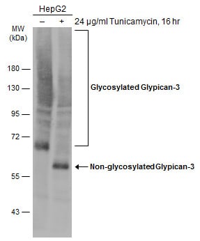 Glypican 3 Antibody (MA5-31547)