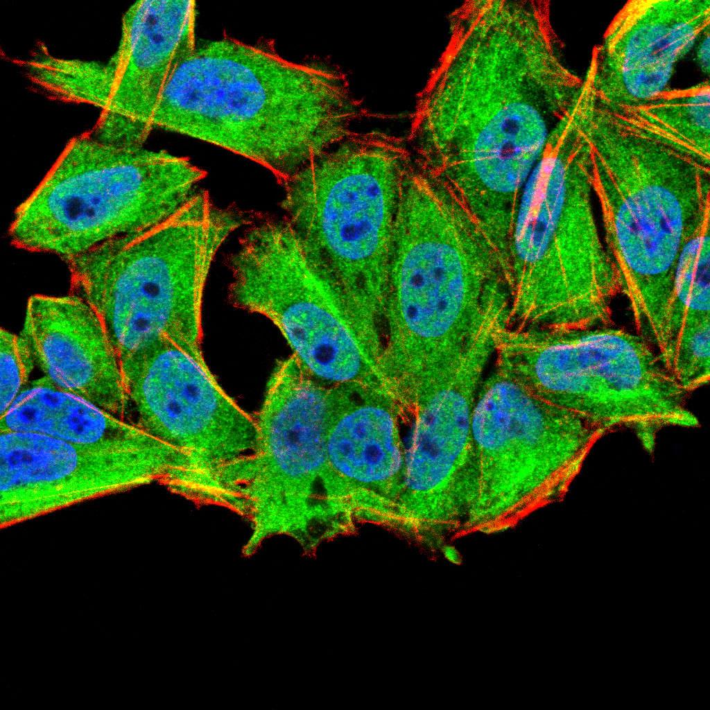 MURF1 Antibody (MA5-31806)