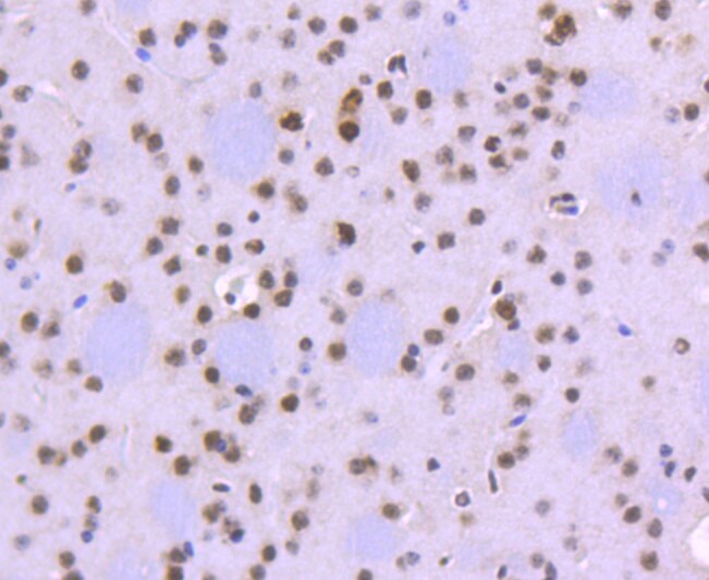 FUBP1 Antibody in Immunohistochemistry (Paraffin) (IHC (P))
