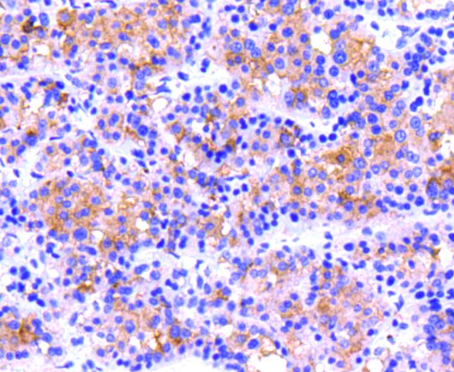 CD61 (Integrin beta 3) Antibody in Immunohistochemistry (Paraffin) (IHC (P))