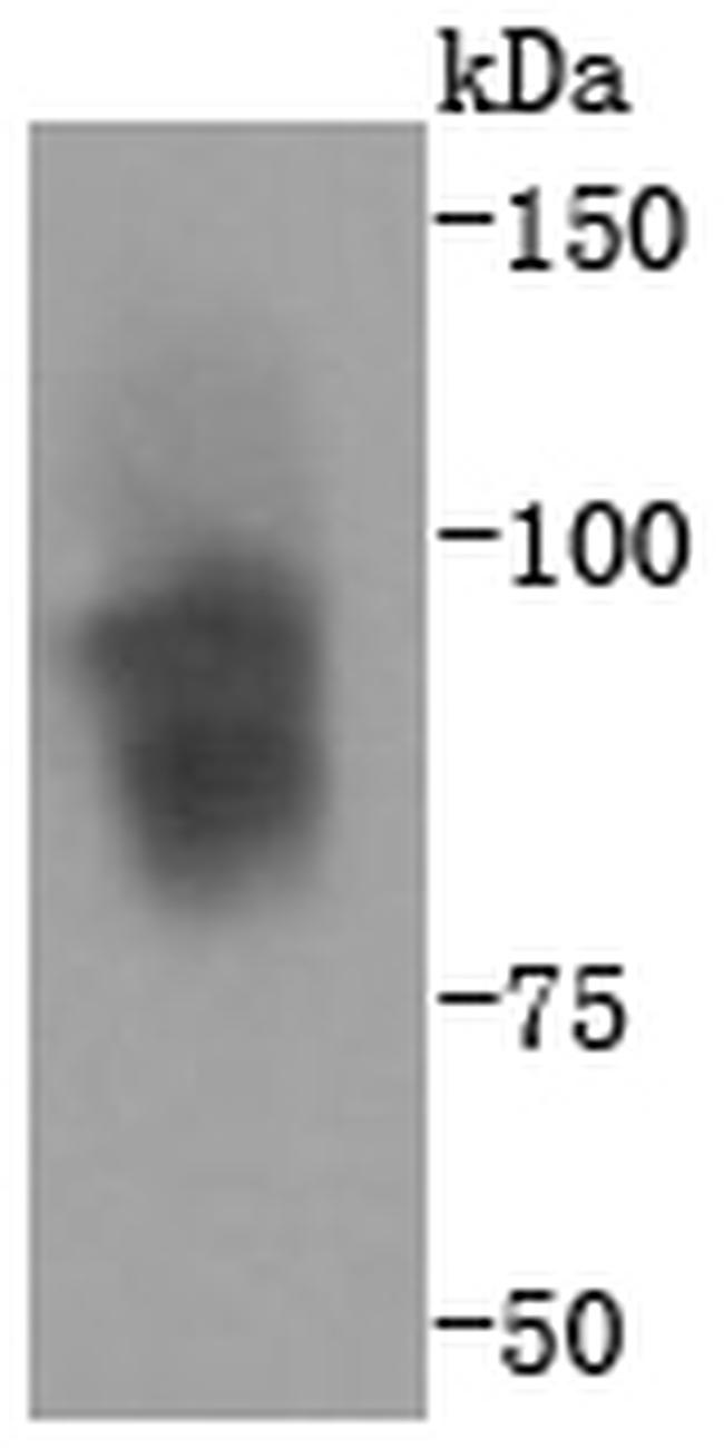 CD61 (Integrin beta 3) Antibody in Western Blot (WB)