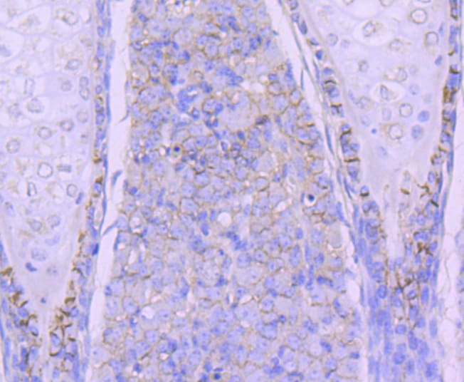 N-cadherin Antibody (MA5-32088)