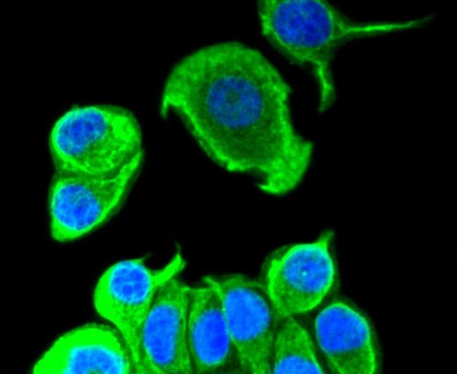 Cytokeratin 8 Antibody (MA5-32118)