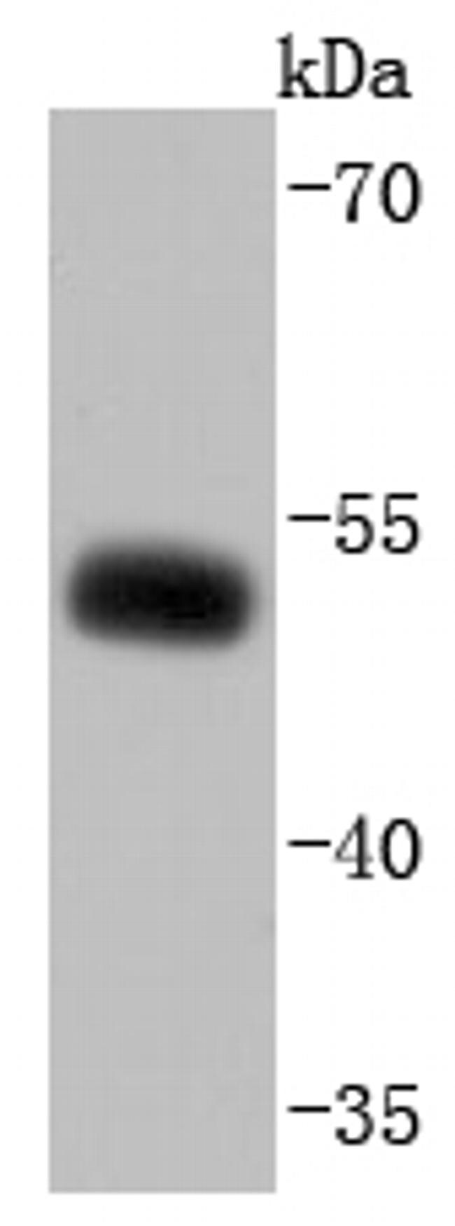 EBP50 Antibody in Western Blot (WB)