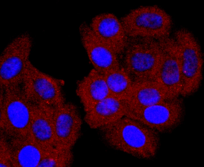 CD74 Antibody (MA5-32529)