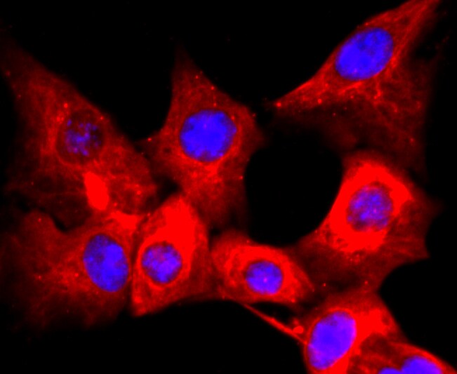 CD59 (Protectin) Antibody (MA5-32588)