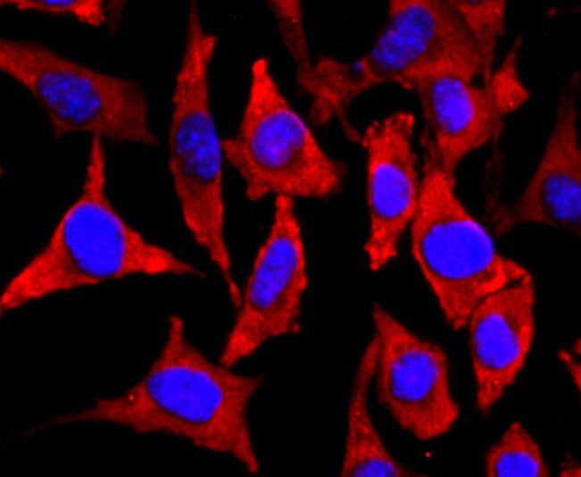 NEFM Antibody (MA5-32613)