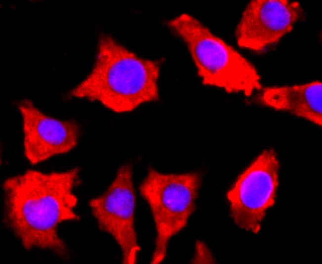 FGFR3 Antibody (MA5-32620)