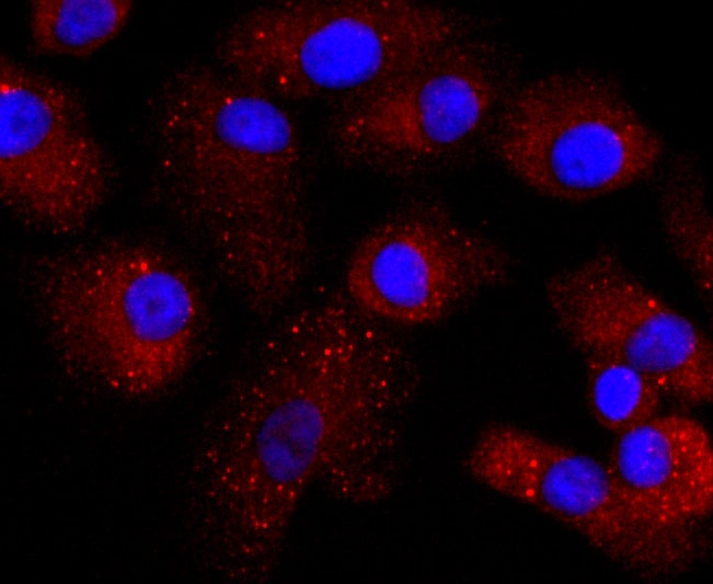 Transthyretin Antibody (MA5-32634)