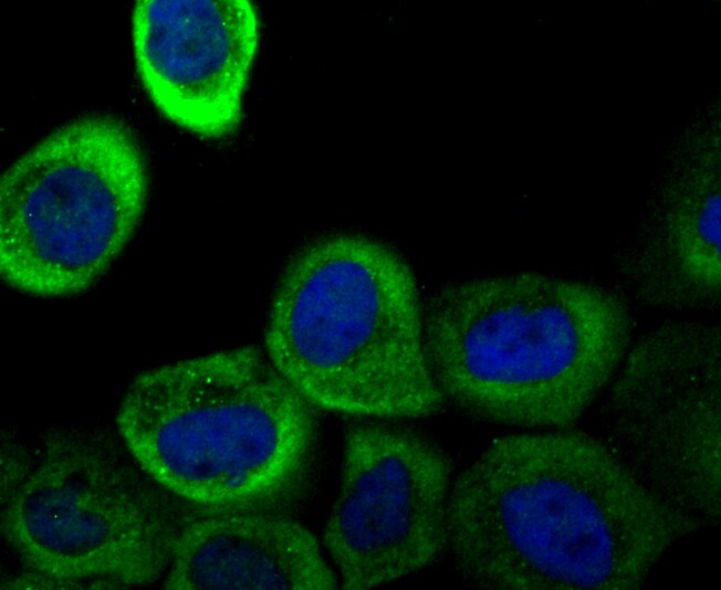 Galectin 1 Antibody (MA5-32779)