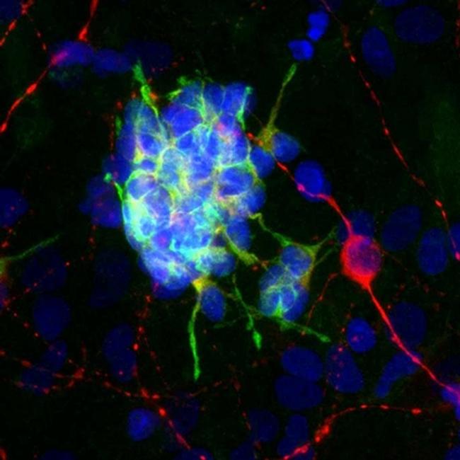 Doublecortin Antibody (MA5-33102)