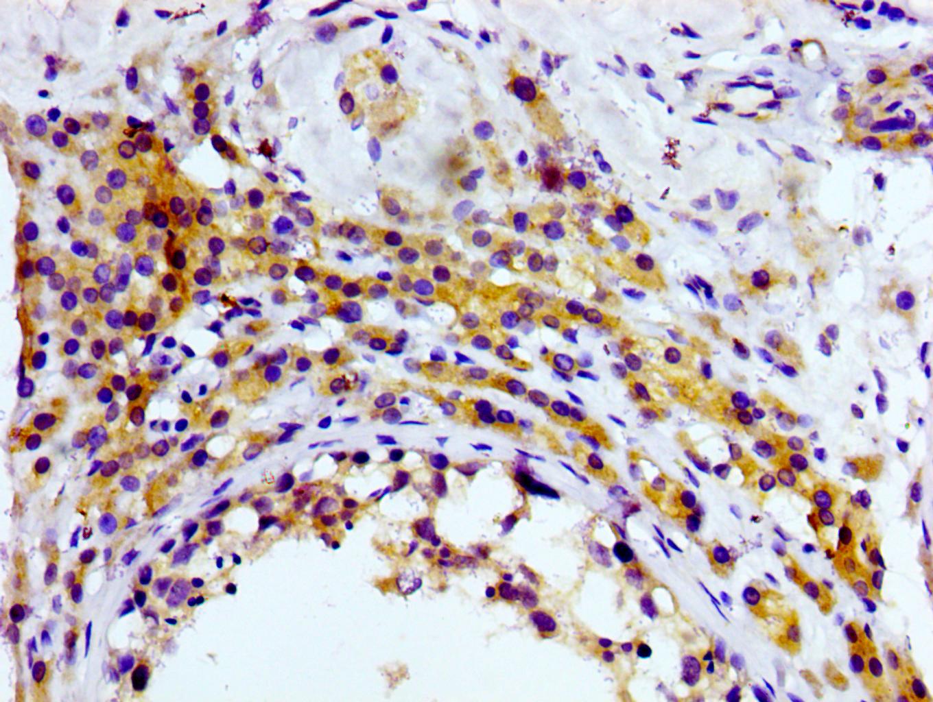 CD81 Antibody (MA5-33123)