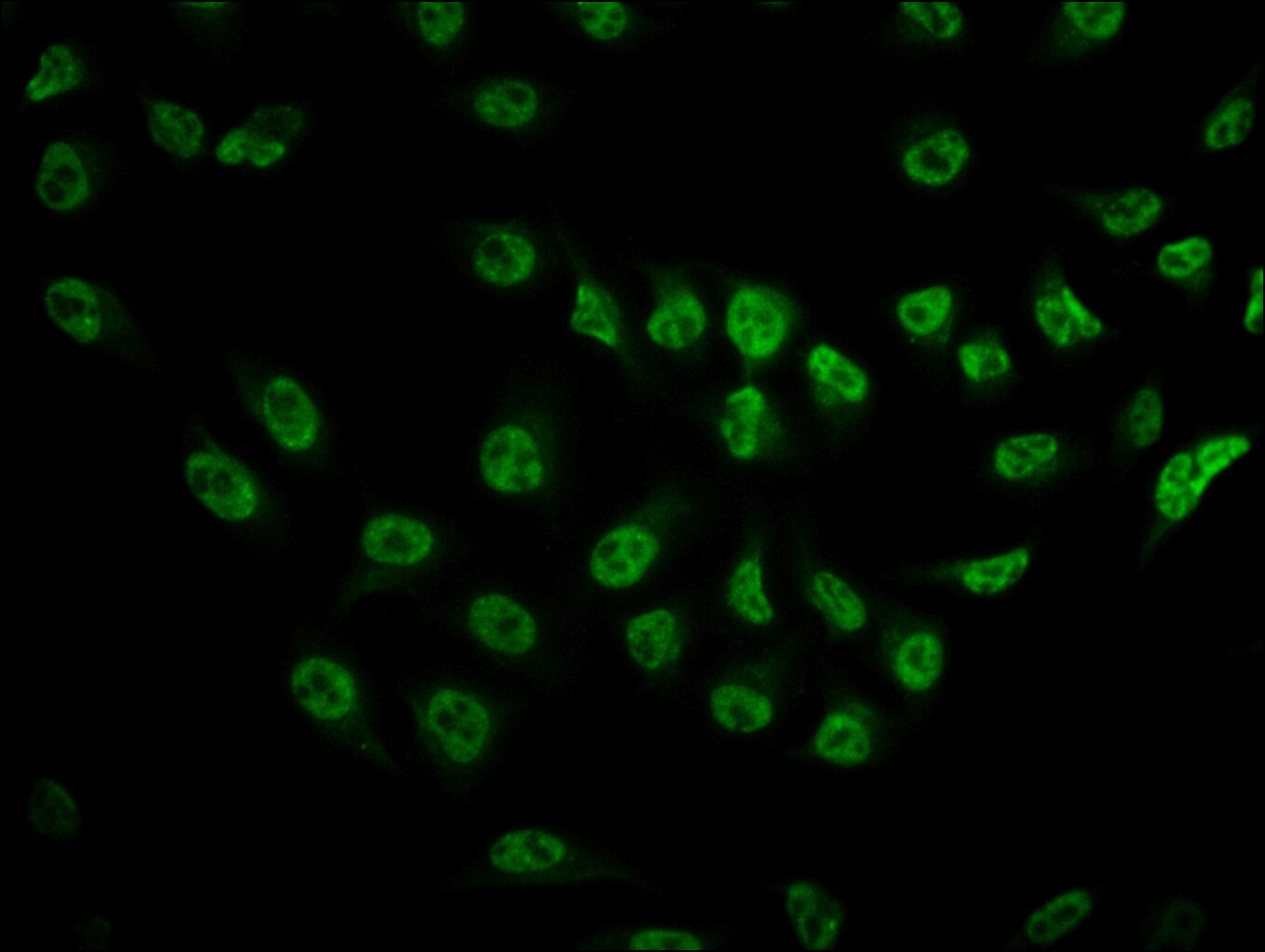 Phospho-mTOR (Ser2481) Antibody (MA5-33139)