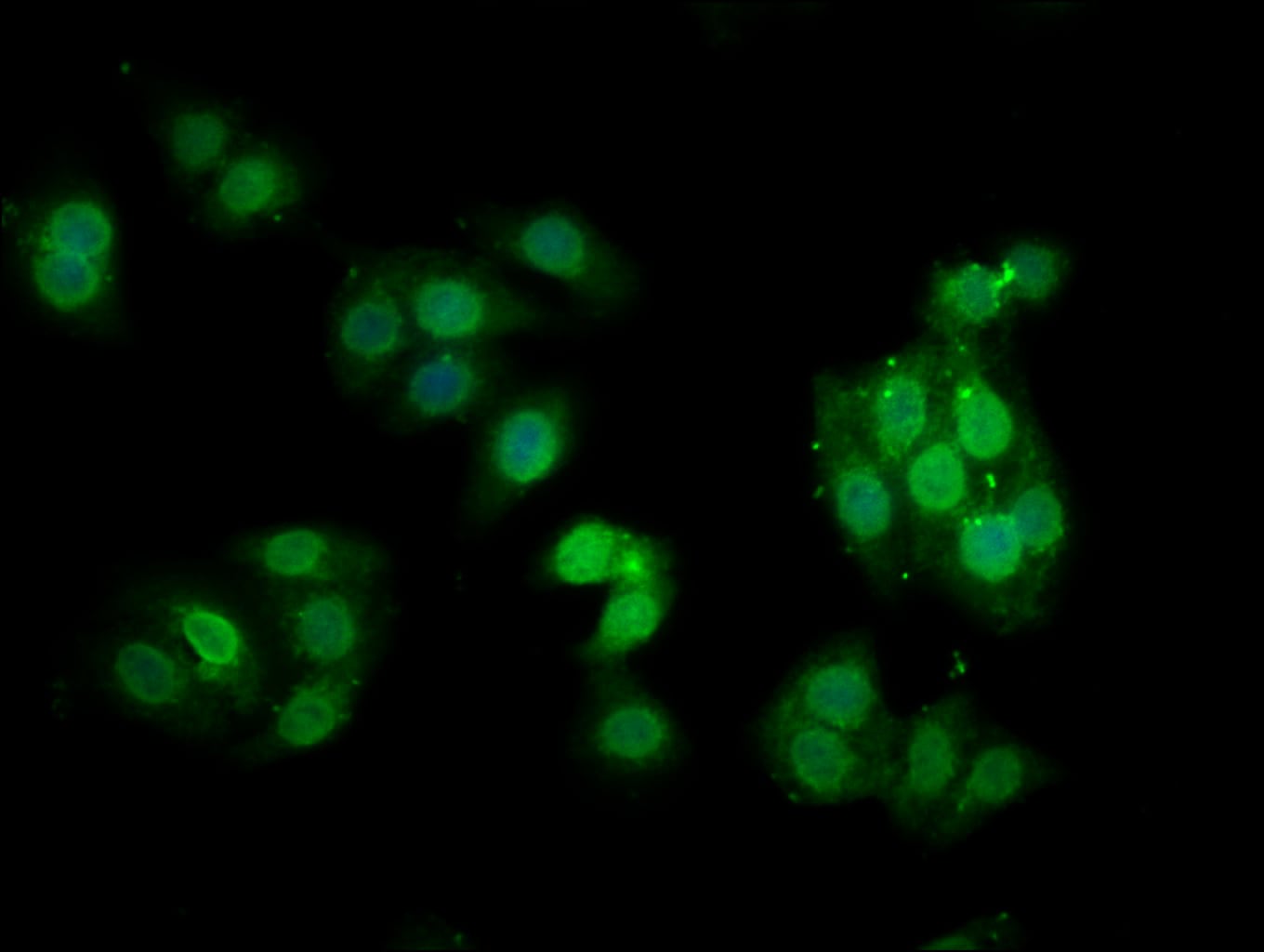 Phospho-PKC alpha (Thr638) Antibody (MA5-33191)