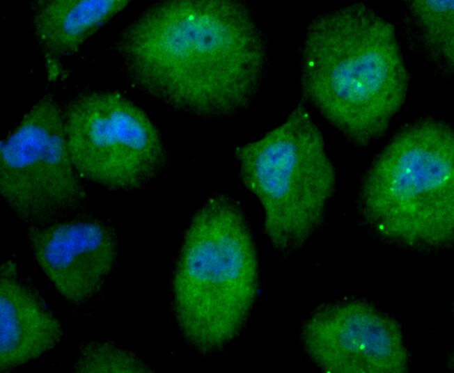 Nesprin 1 Antibody (MA5-34670)