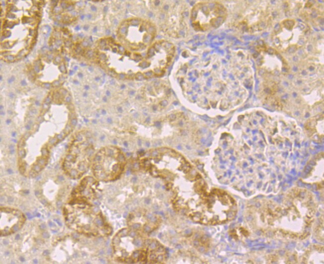 CLASP1 Antibody in Immunohistochemistry (Paraffin) (IHC (P))