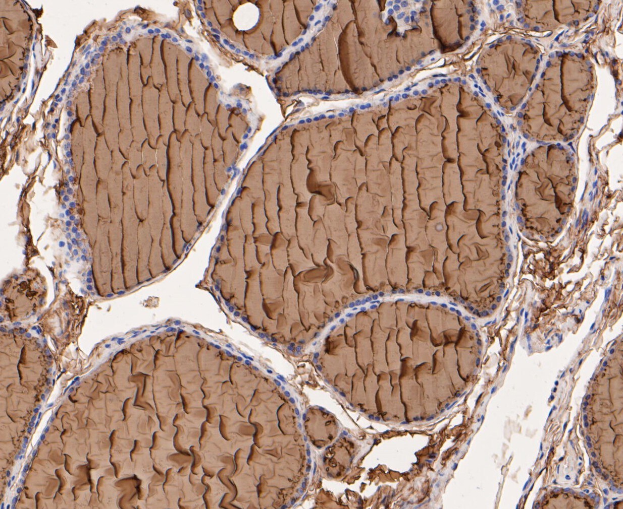 Thyroglobulin antibody ma5 34856 